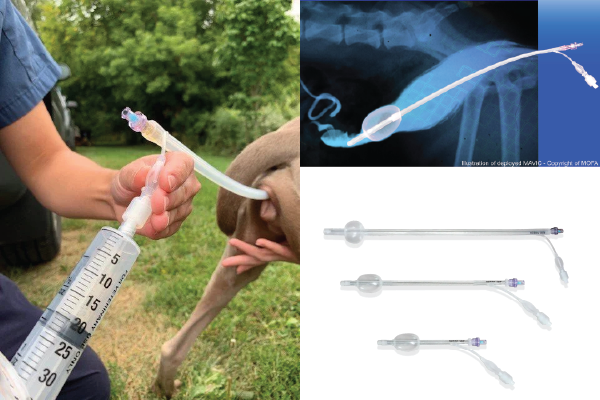 バルーンカテーテルによる膣内人工授精